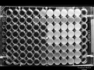 K Hari Krishnan 
Tirunelveli Medical 
College 
 