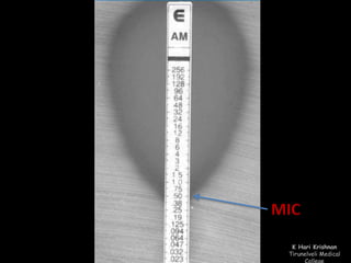 MIC 
K Hari Krishnan 
Tirunelveli Medical 
College 
 
