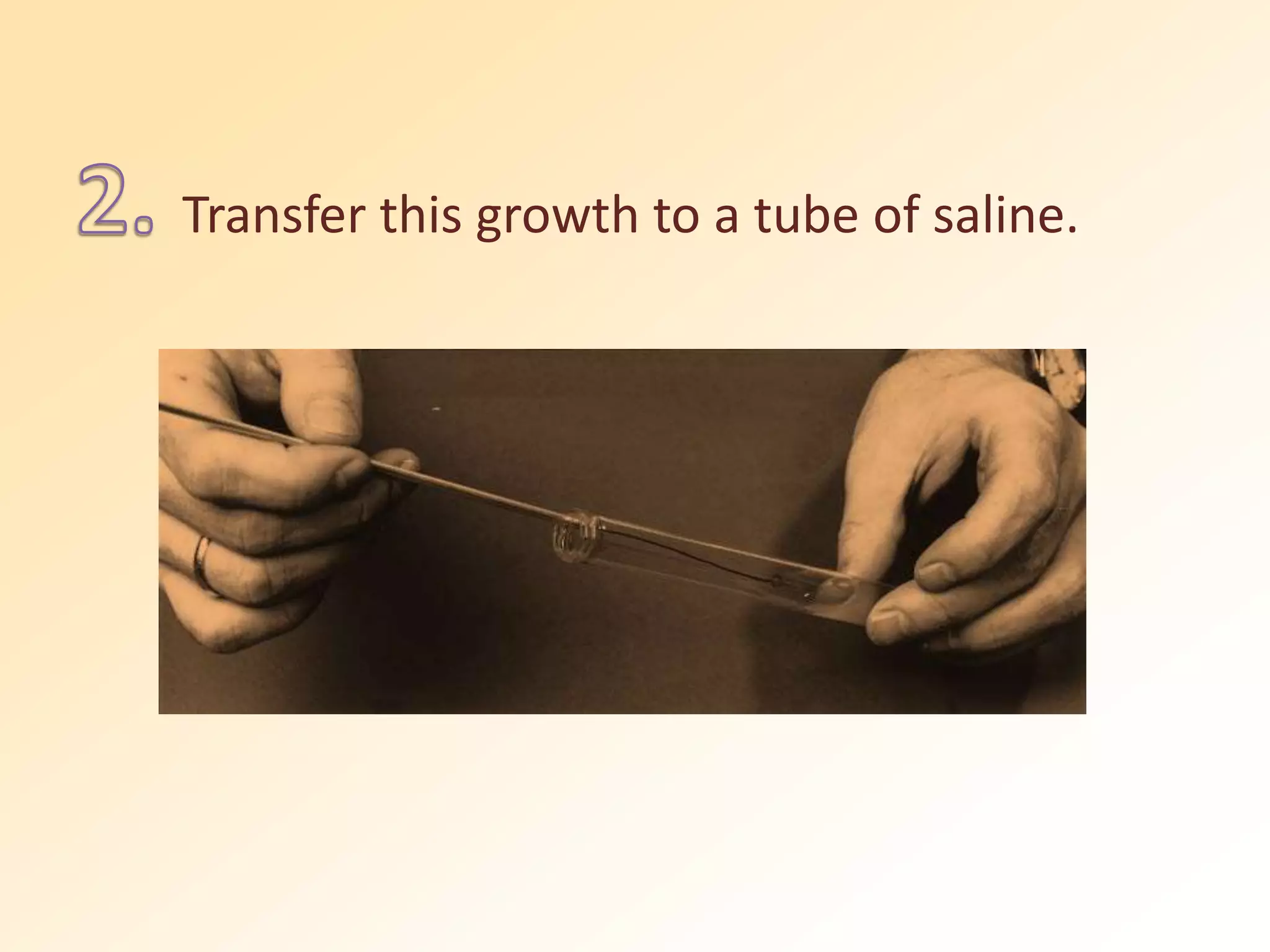 Transfer this growth to a tube of saline.
 
