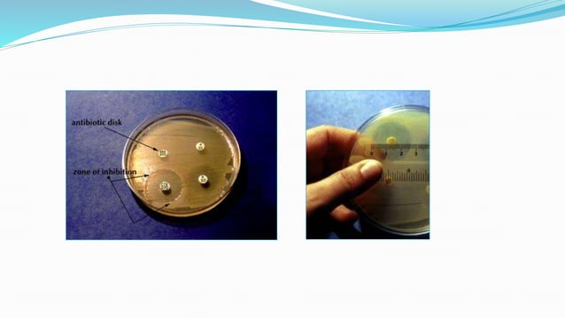 Antibiotic sensitivity testing | PPTX