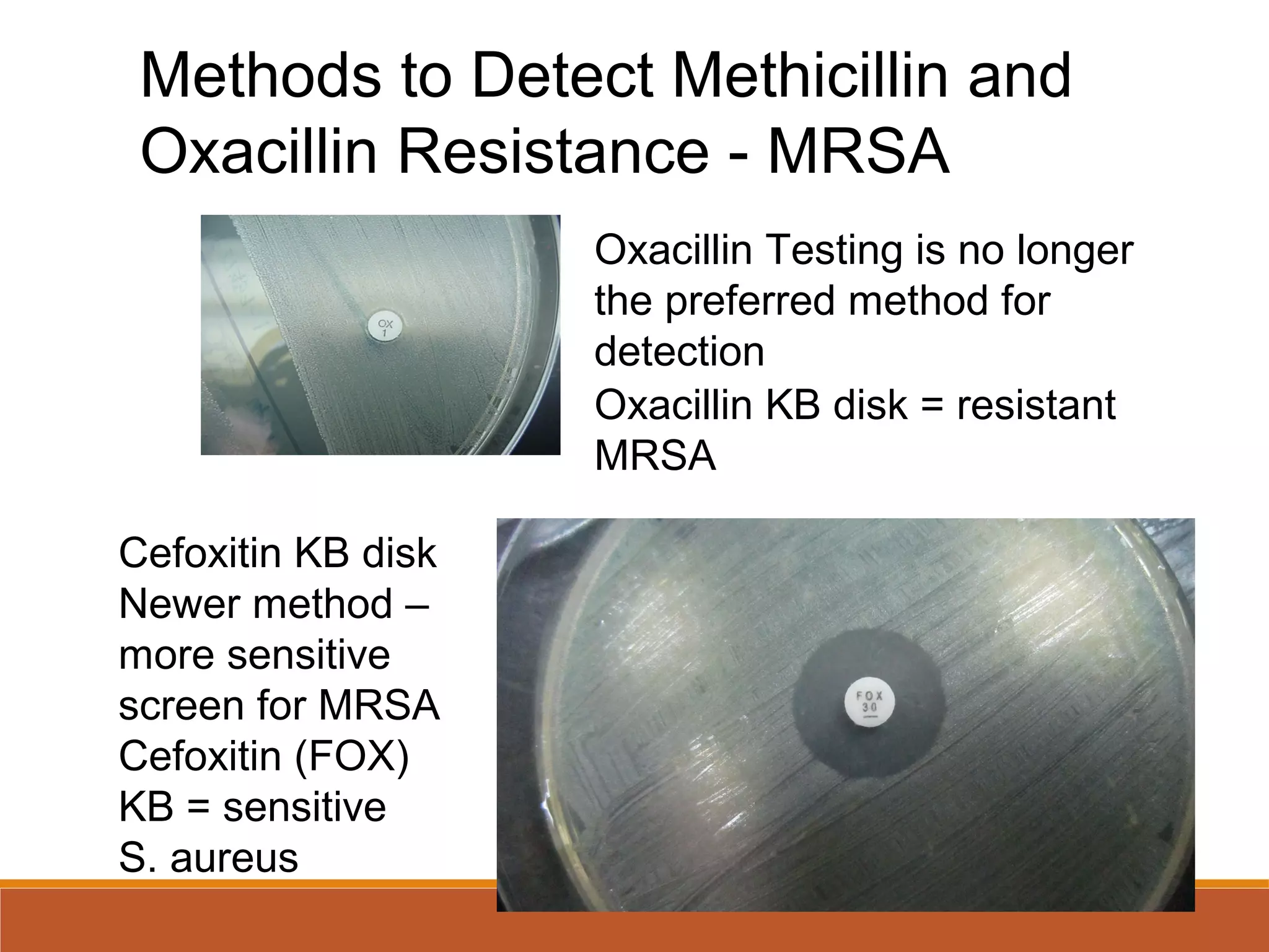 Oxacillin KB disk = resistant
MRSA
Cefoxitin KB disk
Newer method –
more sensitive
screen for MRSA
Cefoxitin (FOX)
KB = sensitive
S. aureus
Methods to Detect Methicillin and
Oxacillin Resistance - MRSA
Oxacillin Testing is no longer
the preferred method for
detection
 