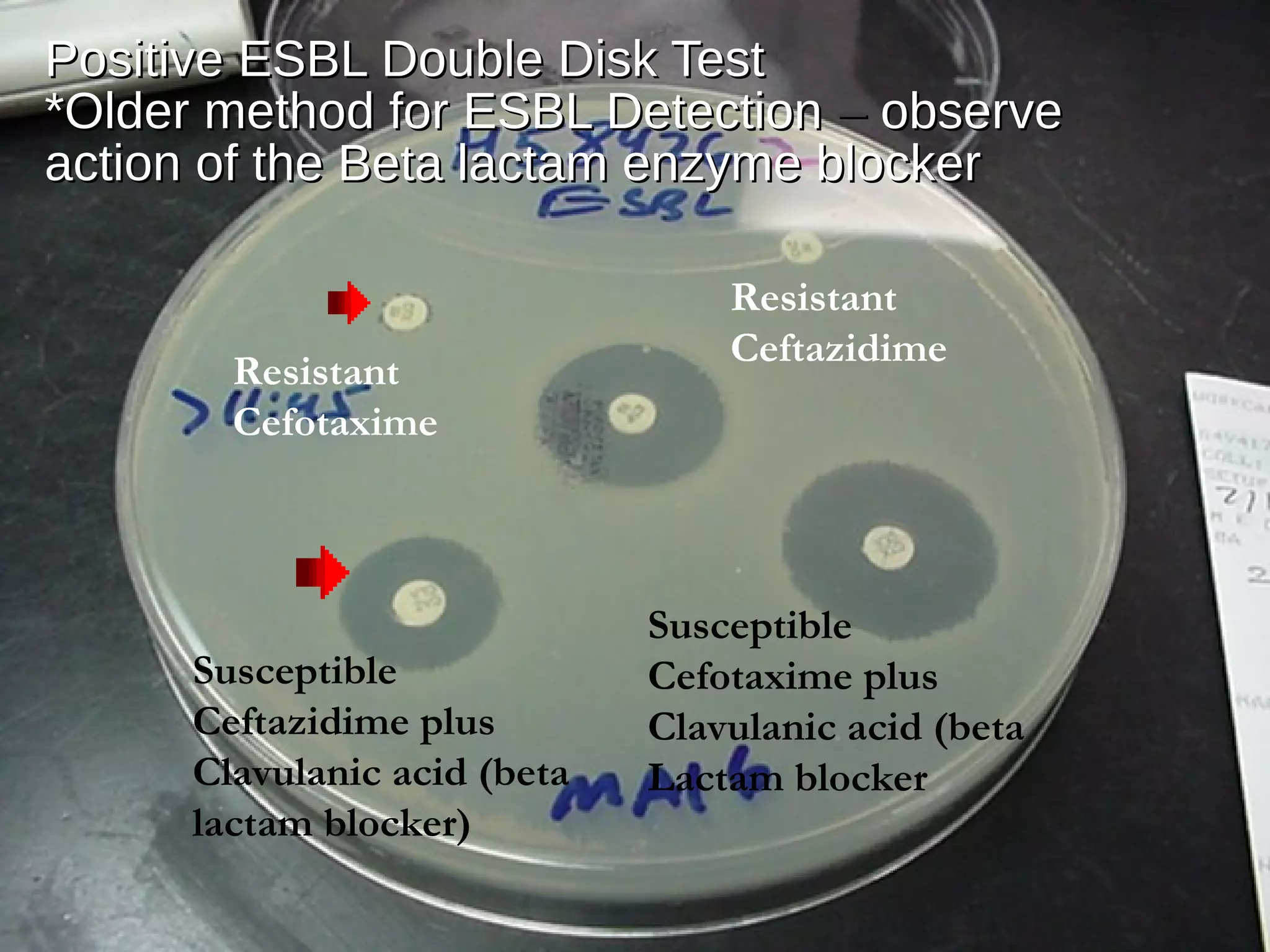 Positive ESBL Double Disk TestPositive ESBL Double Disk Test
*Older method for ESBL Detection*Older method for ESBL Detection –– observeobserve
action of the Beta lactam enzyme blockeraction of the Beta lactam enzyme blocker
Resistant
Cefotaxime
Resistant
Ceftazidime
Susceptible
Ceftazidime plus
Clavulanic acid (beta
lactam blocker)
Susceptible
Cefotaxime plus
Clavulanic acid (beta
Lactam blocker
 