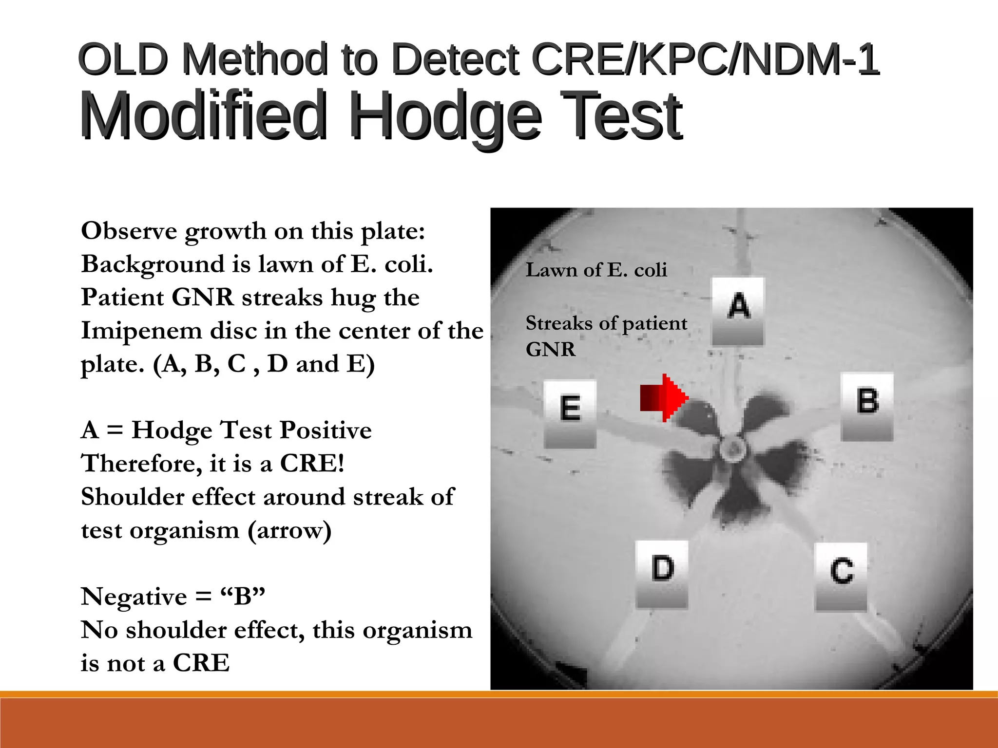 OLD Method to Detect CRE/KPC/NDM-1OLD Method to Detect CRE/KPC/NDM-1
Modified Hodge TestModified Hodge Test
Observe growth on this plate:
Background is lawn of E. coli.
Patient GNR streaks hug the
Imipenem disc in the center of the
plate. (A, B, C , D and E)
A = Hodge Test Positive
Therefore, it is a CRE!
Shoulder effect around streak of
test organism (arrow)
Negative = “B”
No shoulder effect, this organism
is not a CRE
Lawn of E. coli
Streaks of patient
GNR
 