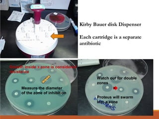Kirby Bauer disk Dispenser
Each cartridge is a separate
antibiotic
Growth inside a zone is considered
resistance
Measure the diameter
of the zone of inhibition
Watch out for double
zones
Proteus will swarm
Into a zone
 