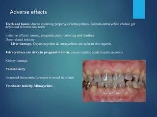 Adverse effects
Teeth and bones: due to chelating property of tetracyclines, calcium-tetracycline chelate get
deposited in bones and teeth
Irritative effects: nausea, epigastric pain, vomiting and diarrhea
Dose related toxicity
Liver damage. Oxytetracycline & tetracyclines are safer in this regards.
Tetracyclines are risky in pregnant women, can precipitate acute hepatic necrosis
Kidney damage
Phototoxicity
Increased intracranial pressure is noted in infants
Vestibular toxicity-Minocycline.
 