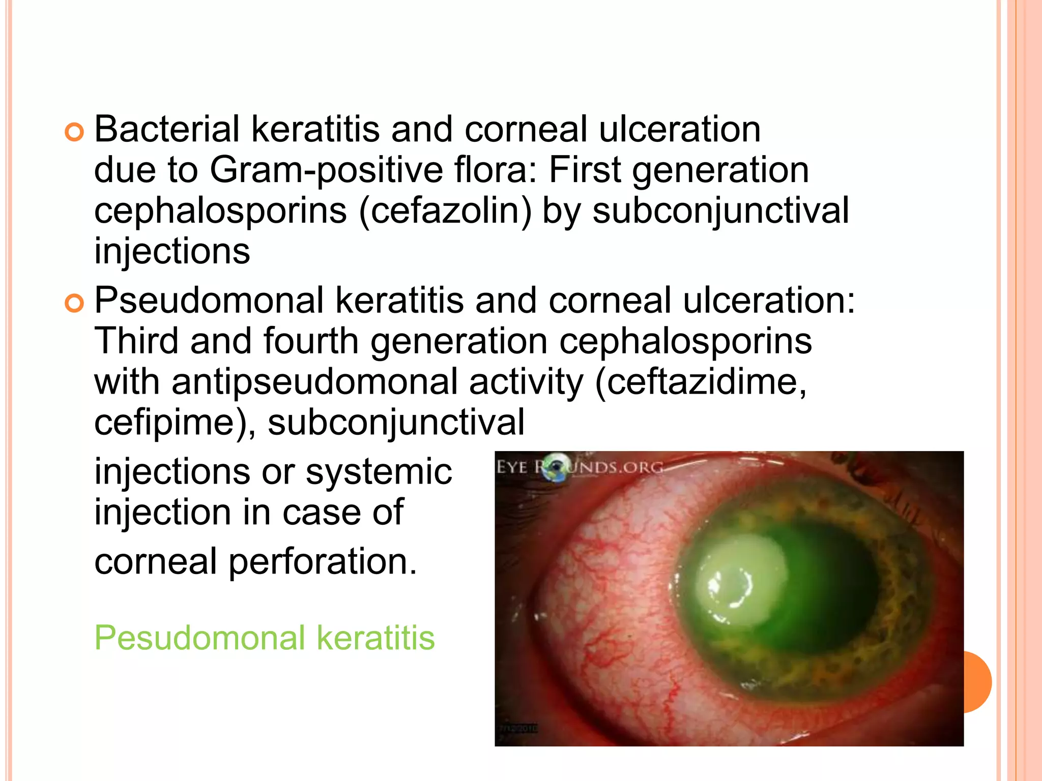 Antibiotics in ophthalmology | PPTX