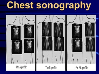 Chest sonography
 