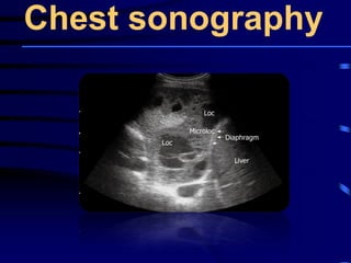 Chest sonography
 