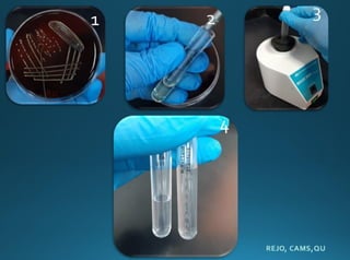 Antibiotic Sensitivity test (AST) | PDF