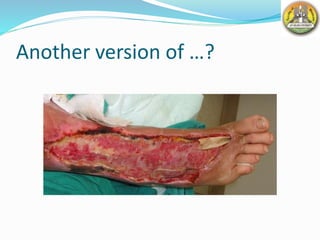 Another version of …?
 