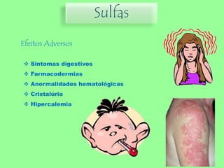 Sulfas
Efeitos Adversos
 Sintomas digestivos
 Farmacodermias
 Anormalidades hematológicas
 Cristalúria
 Hipercalemia
 
