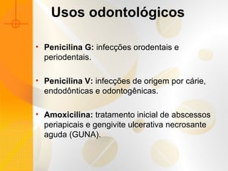 Usos odontológicos
• Penicilina G: infecções orodentais e
periodentais.
• Penicilina V: infecções de origem por cárie,
endodônticas e odontogênicas.
• Amoxicilina: tratamento inicial de abscessos
periapicais e gengivite ulcerativa necrosante
aguda (GUNA).
 