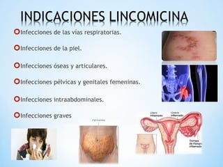 Infecciones de las vías respiratorias.
Infecciones de la piel.
Infecciones óseas y articulares.
Infecciones pélvicas y genitales femeninas.
Infecciones intraabdominales.
Infecciones graves
 