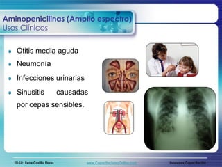 Aminopenicilinas (Amplio espectro)
Usos Clínicos


    Otitis media aguda
    Neumonía
    Infecciones urinarias
    Sinusitis                     causadas
    por cepas sensibles.




   EU-Lic. Rene Castillo Flores          www.CapacitacionesOnline.com   Innovares Capacitación
 