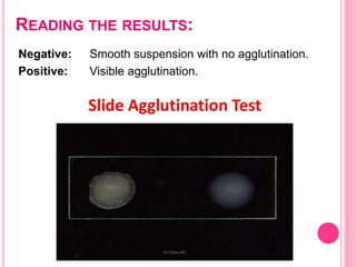 READING THE RESULTS:
Negative: Smooth suspension with no agglutination.
Positive: Visible agglutination.
 