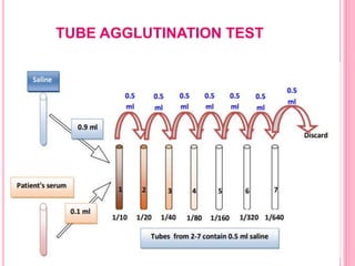 TUBE AGGLUTINATION TEST
 