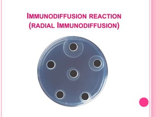 IMMUNODIFFUSION REACTION
(RADIAL IMMUNODIFFUSION)
 