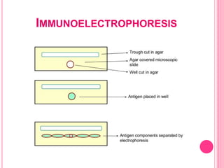IMMUNOELECTROPHORESIS
 