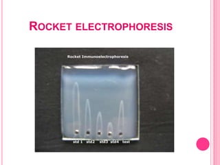 ROCKET ELECTROPHORESIS
 