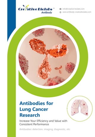 Antibodies for
Lung Cancer
Research
Antibodies: detection, imaging, diagnostic, etc.
Increase Your Efficiency and Value with
Consistent Performance
info@creative-biolabs.com
www.antibody-creativebiolabs.com
 