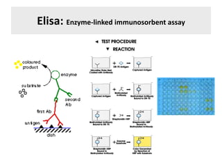 Elisa: Enzyme-linked immunosorbent assay
 