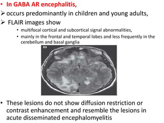 • In GABA AR encephalitis,
occurs predominantly in children and young adults,
 FLAIR images show
• multifocal cortical and subcortical signal abnormalities,
• mainly in the frontal and temporal lobes and less frequently in the
cerebellum and basal ganglia
• These lesions do not show diffusion restriction or
contrast enhancement and resemble the lesions in
acute disseminated encephalomyelitis
 