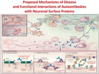 Proposed Mechanisms of Disease
and Functional Interactions of Autoantibodies
with Neuronal Surface Proteins
 