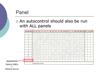 Panel
 An autocontrol should also be run
with ALL panels
Autocontrol
Patient RBCs
+
Patient serum
 