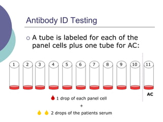 Antibody ID Testing
 A tube is labeled for each of the
panel cells plus one tube for AC:
AC
1 2 3 4 5 6 7 8 9 10 11
1 drop of each panel cell
+
2 drops of the patients serum
 
 
