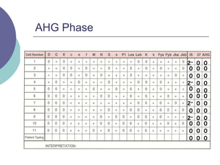 AHG Phase
2+
0
0
2+
0
0
2+
0
0
2+
0
0
0
0
0
0
0
0
0
0
0
0
0
0
0
0
0
0
0
0
0
0
0
0 0 0
 