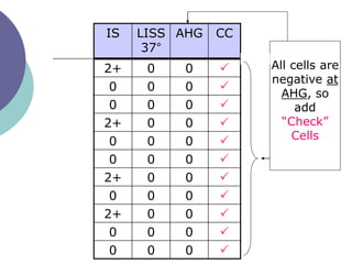 IS LISS
37°
AHG CC
2+ 0 0 
0 0 0 
0 0 0 
2+ 0 0 
0 0 0 
0 0 0 
2+ 0 0 
0 0 0 
2+ 0 0 
0 0 0 
0 0 0 
All cells are
negative at
AHG, so
add
“Check”
Cells
 
