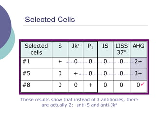Selected Cells
Selected
cells
S Jka P1 IS LISS
37°
AHG
#1 + 0 0 0 0 2+
#5 0 + 0 0 0 3+
#8 0 0 + 0 0 0
These results show that instead of 3 antibodies, there
are actually 2: anti-S and anti-Jka

 