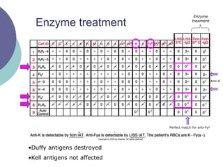 Enzyme
treament
Anti-K
Perfect match for anti-Fya
•Duffy antigens destroyed
•Kell antigens not affected
Enzyme treatment
 