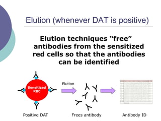 Elution (whenever DAT is positive)
Elution techniques “free”
antibodies from the sensitized
red cells so that the antibodies
can be identified
Y
Y
Y
Y
Sensitized
RBC
Positive DAT
Elution
Y
Frees antibody Antibody ID
 