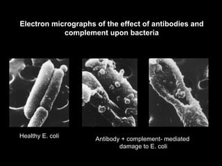 Antibody + complement- mediated  damage to E. coli Healthy E. coli Electron micrographs of the effect of antibodies and complement upon bacteria 