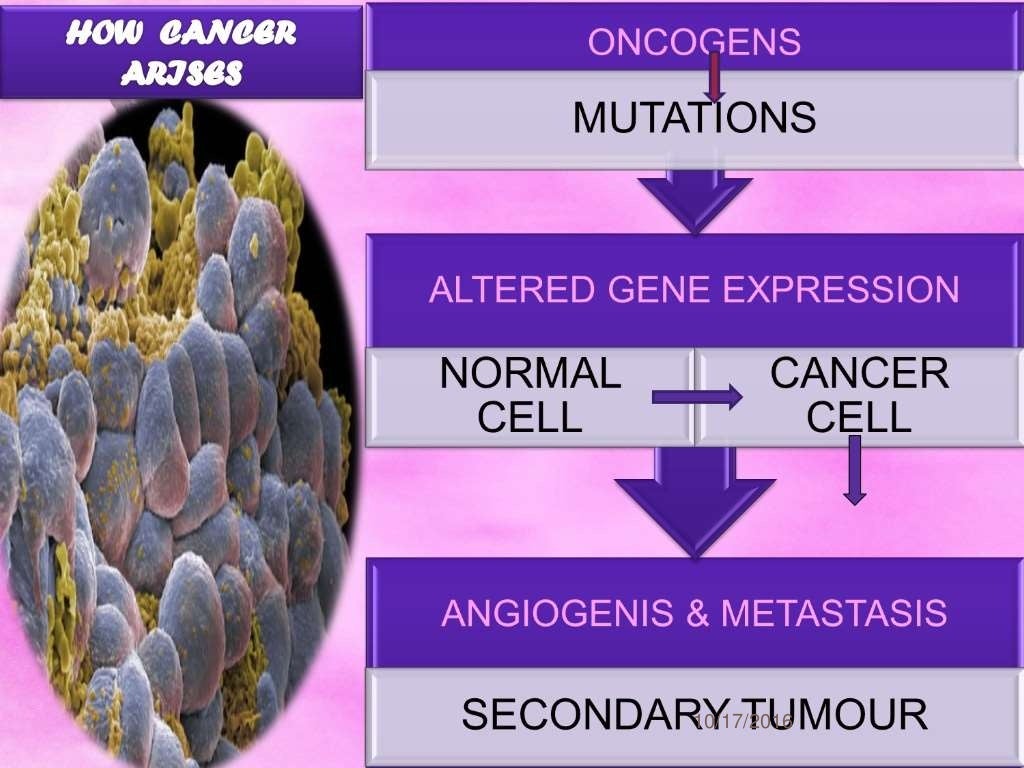 NEOPLASTIC DISEASE