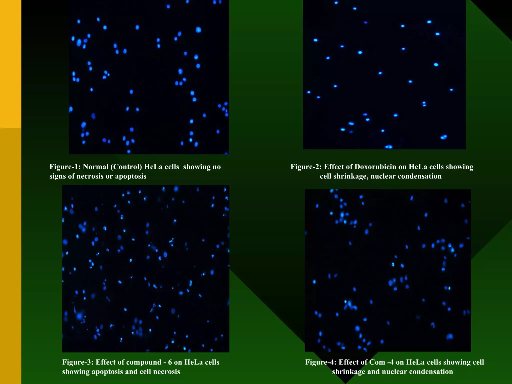 Figure-1: Normal (Control) HeLa cells  showing no signs of necrosis or apoptosis Figure-2: Effect of Doxorubicin on HeLa cells showing cell shrinkage, nuclear condensation  Figure-3: Effect of compound - 6 on HeLa cells showing apoptosis and cell necrosis Figure-4: Effect of Com -4 on HeLa cells showing cell shrinkage and nuclear condensation  