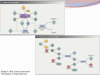 Rodger L. Bick. Cancer-Associated
Thrombosis. N Engl J Med 2003
 