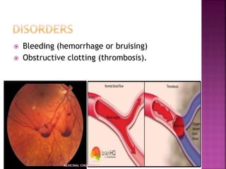  Bleeding (hemorrhage or bruising)
 Obstructive clotting (thrombosis).
 