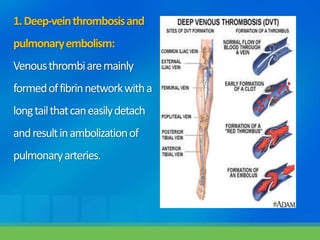1.Deep-veinthrombosisand
pulmonaryembolism:
Venousthrombiaremainly
formedoffibrinnetworkwitha
longtailthatcaneasilydetach
andresultinambolizationof
pulmonaryarteries.
 