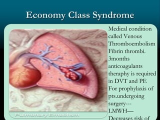 Economy Class Syndrome
Medical condition
called Venous
Thromboembolism
Fibrin thrombi.
3months
anticoagulants
theraphy is required
in DVT and PE
For prophylaxis of
pts.undergoing
surgery---
LMWH—
 