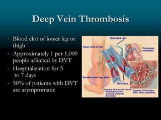 Deep Vein Thrombosis
 Blood clot of lower leg or
thigh
 Approximately 1 per 1,000
people affected by DVT
 Hospitalization for 5
to 7 days
 50% of patients with DVT
are asymptomatic
 