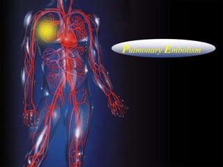 Deep Vein ThrombosisEmbolusPulmonary Embolism
 