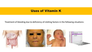 Treatment of bleeding due to deficiency of clotting factors in the following situations:
Uses of Vitamin K
 