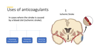 Uses of anticoagulants
In cases where the stroke is caused
by a blood clot (ischemic stroke).
Preventing
clot formation
Dissolving
existing clot
Restoring
blood flow
1.
 