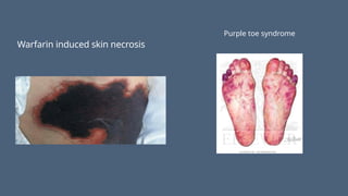 Warfarin induced skin necrosis
Purple toe syndrome
 