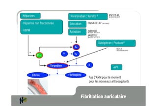 Héparines                               Rivaroxaban : Xarelto ®                   ROCKET-AF
                                                                                  NEJM 2011;365:883-91



- Héparine non fractionnée              Edoxaban      ENGAGE-AF (en cours)
  Héparines
- HBPM                                  Apixaban      AVERROES
                                                      NEJM 2011; 364 : 806-17

                                                      ARISTOTLE
                                                      NEJM 2011; 365 : 981-92


                                         -                                Dabigatran : Pradaxa®
                                             Xa
                                                                                               RE-LY
                                                                                               NEJM 2009;361:1139-51
      +                            V         Va
              ATIII

                                   -
                       Thrombine                       II
                                                                                         AVK

          Fibrine                      Fibrinogène
                                                        Pas d’AMM pour le moment
                                                        pour les nouveaux anticoagulants



                                                  Fibrillation auriculaire
 