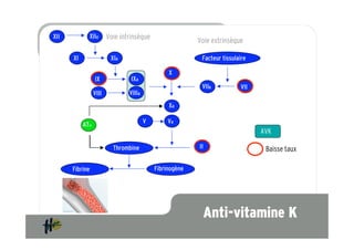 XII           XIIa        Voie intrinsèque                  Voie extrinsèque

      XI                   XIa                               Facteur tissulaire

                                                   X
                   IX              IXa
                                                             VIIa           VII
                   VIII           VIIIa
                                                   Xa

                                          V        Va
           ATIII
                                                                                  AVK

                            Thrombine                       II                     Baisse taux

      Fibrine                                 Fibrinogène




                                                                 Anti-vitamine K
 