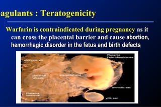 Warfarin is contraindicated during pregnancy as it
can cross the placental barrier and cause abortion,abortion,
hemorrhagic disorder in the fetus and birth defectshemorrhagic disorder in the fetus and birth defects
oagulants : Teratogenicity
 