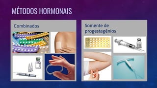 MÉTODOS HORMONAIS
Somente de
progestagênios
Combinados
 